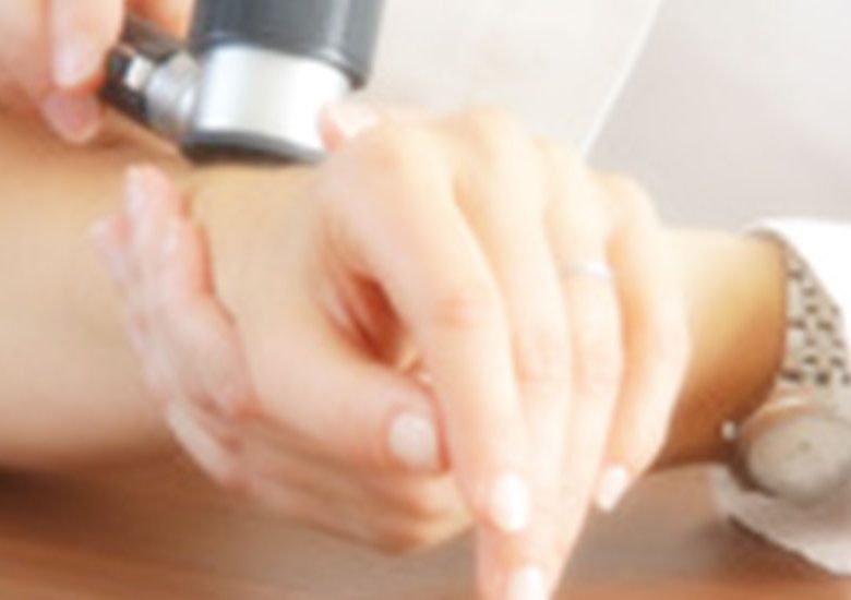 dermatologija dermatoskopija dermatolog dermatovenerolog
